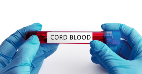 stem cell sample from umbilical cord blood